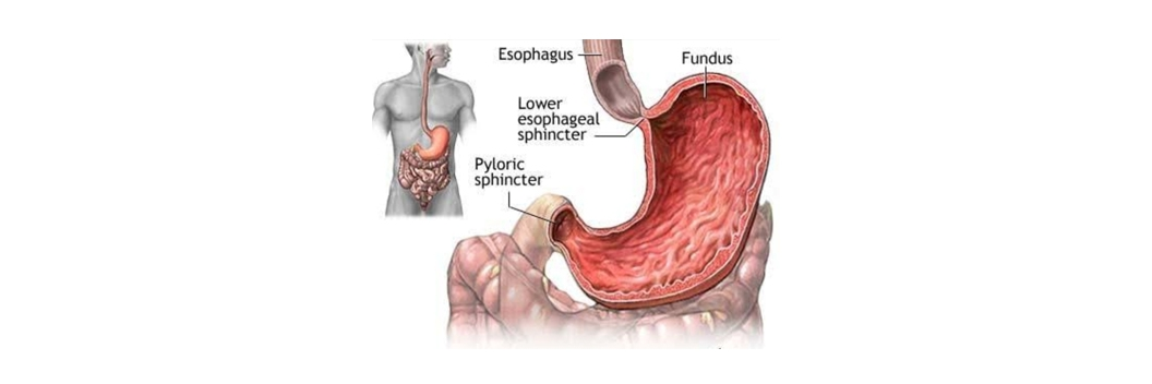 3-Gastric&Reflux-dr-arindam https://gastrosurgeondubai.com/wp-content/uploads/2026/01/3-GastricReflux-dr-arindam.png