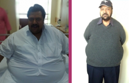 gal-1 https://gastrosurgeondubai.com/wp-content/uploads/2026/01/gal-1.png
