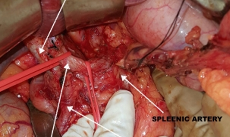 gal-2 https://gastrosurgeondubai.com/wp-content/uploads/2026/01/gal-2.png