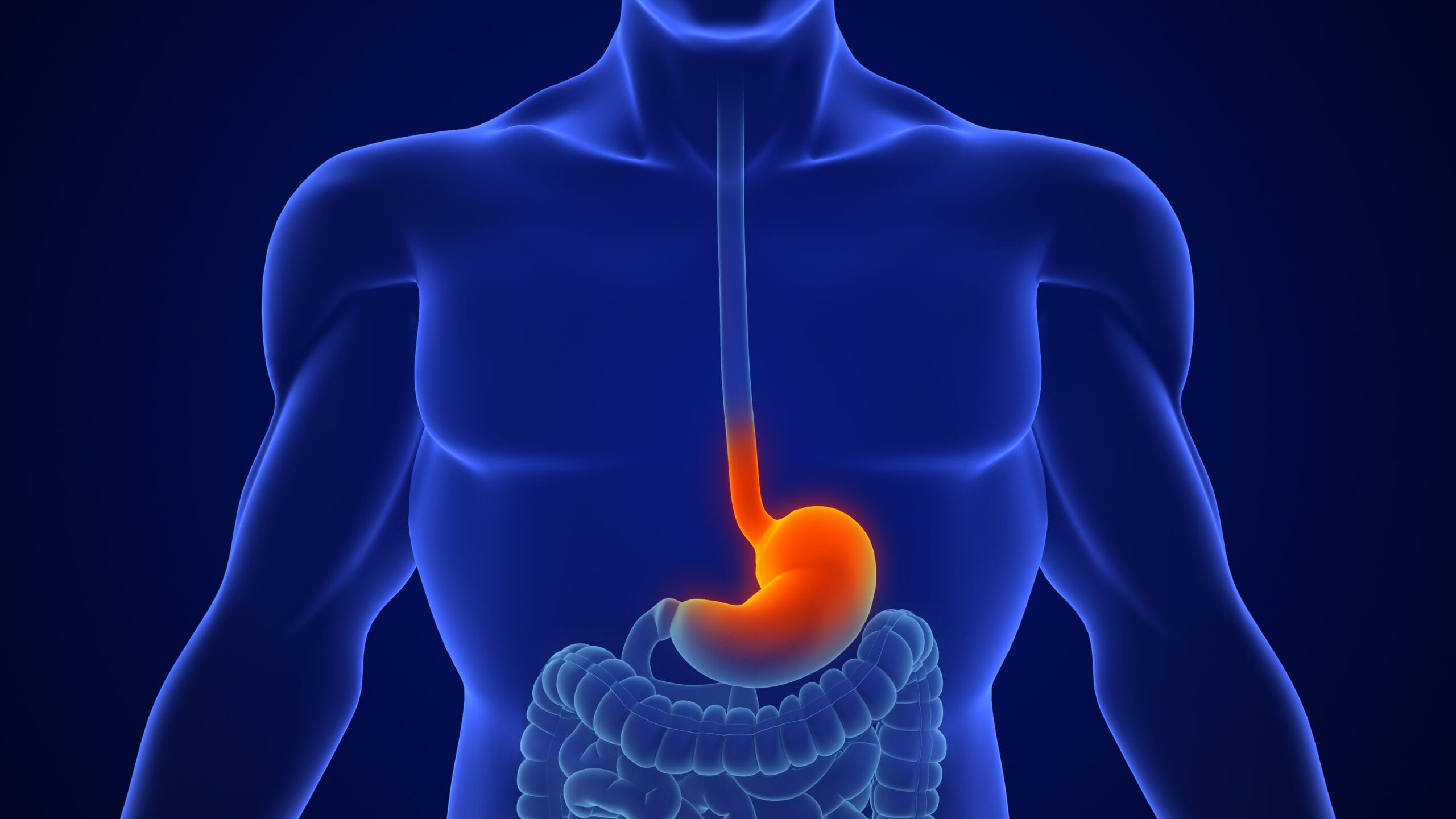 Diagram of the oesophagus, lower oesophageal sphincter (LES) valve and stomach showing acid refluxing back up in GERD