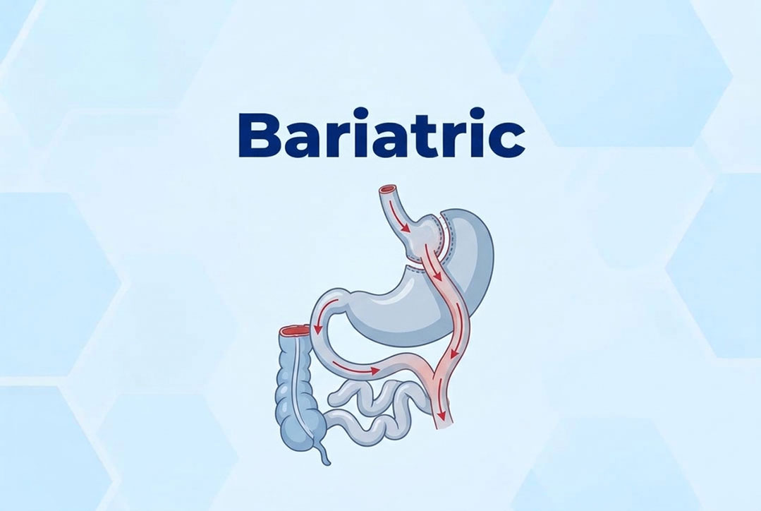 bariatric-image https://gastrosurgeondubai.com/wp-content/uploads/2026/10/bariatric-image.jpg