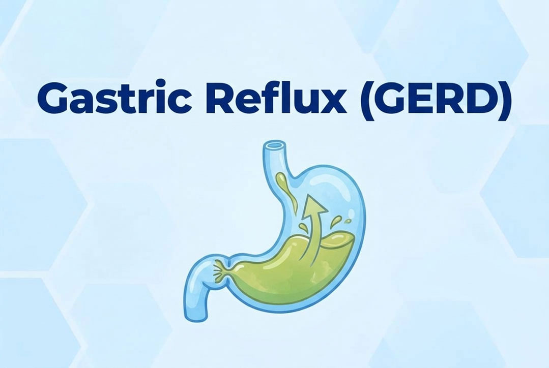 gastric-reflux-image https://gastrosurgeondubai.com/wp-content/uploads/2026/10/gastric-reflux-image.jpg