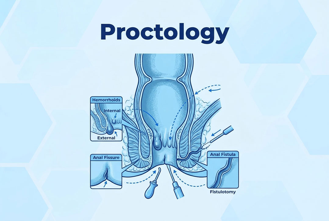 proctology-image https://gastrosurgeondubai.com/wp-content/uploads/2026/10/proctology-image.jpg